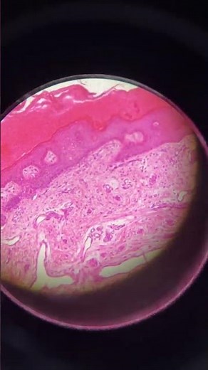 Histological slide of thick skin showing layers of epidermis and dermis and sweat glands