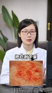 晚上癢的睡不著，可能是爬進你皮膚里了 #疥瘡 #皮膚科普 #漲知識 #醫療健康創作訓練營 #瘙癢 | 皮肤科肖志平医生