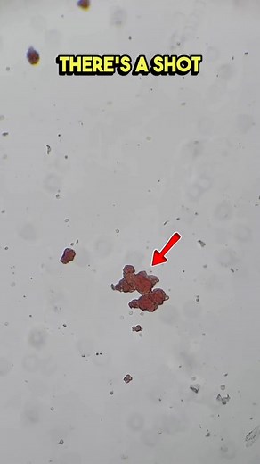 Rh Incompatibility Explained 🔬 #foryouシpage #echorebel #science #bloodtypes | Justice Dodson Microscopy