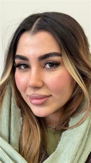 ‎جراحی بینی | بینی نیمه فانتزی | دکتر شهابی‎ on Instagram‎: "آخرشو ببینی تغییرشو متوجه میشی🥹😂 واقعا همه زیباجوهامون همشون نازن وقتی عمـ..ل میکنن ناز تر میشن🩷 دکتر علی شهابی👨🏼‍⚕️ ♦️اگه یه مشاوره با دکتر میخوای ، بدون اینکه بیای مطب کلمه (آنلاین) رو بنویس . با شخص دکتر کاملا را..یگان مشاوره بگیر @dralishahabii 09121314553"‎