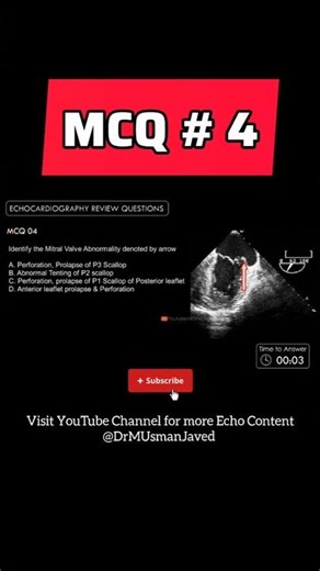 Echo MCQs #ardms Echocardiography for Beginners