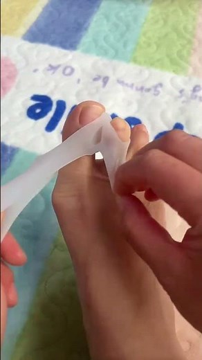 Magic Toe Fixer in Action