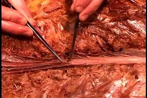 8K views · 225 reactions | Intrinsic muscles of the back, vertebral | Medical Students | Facebook