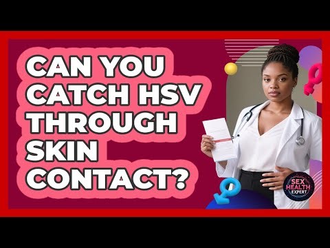 Can You Catch HSV Through Skin Contact?