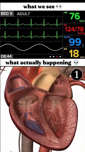 Can you identify all 8 ECG rhythms? #ecg #ekg #ecginterpretation #cardiology