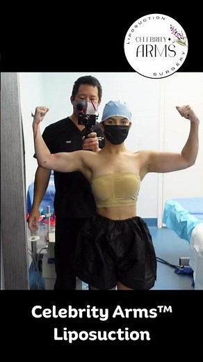 90% Fat Gone? Awake 360 Arm Lipo with Dr. Thomas Su | Halfway Through Surgery 💪