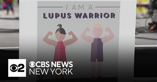 New lupus research and treatment options