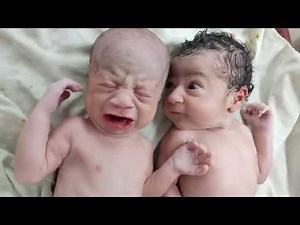 Cutest Twins Newborn Babies after birth where one is fed up with other one cry