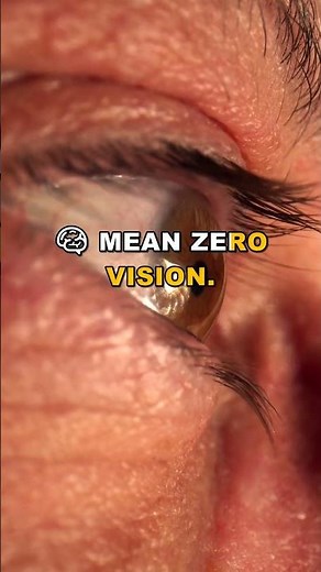 Your Eyes Are Lying to You: The Truth About Brain Illusions