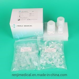 [Hot Item] CE Ivd İşaretli Spin Kolon Yöntemi Viral DNA / RNA Nükleik Asit Ekstraksiyon Kiti Reaktör Kitleri Gerçek Zamanlı PCR için