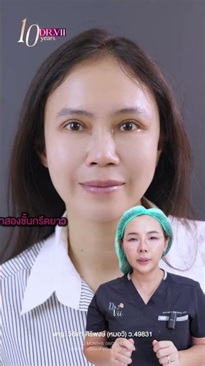 ตาปรือแค่นิดเดียว หากไม่แก้ไข อาจเกิดปัญหาหลังทำตาได้ เพราะ!!!