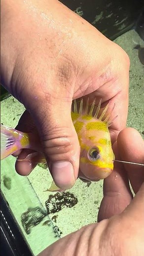 Borbonius Anthias has Popeye Syndrome and person pierces the outer area to relieve tension