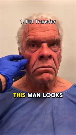 This man looks 20 years younger after an incredible transformation that will leave you speechless! Check in Comments 👇👇👇 | Interesting Stories