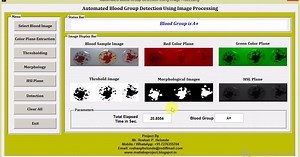Blood Group Detection Using Image Processing Matlab Project with Source Code