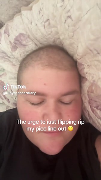 Understanding the Experience of Picc Line Removal