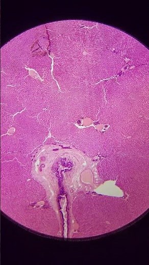 Liver at 25x, 40x, 100x, 200x and 400x magnification | Liver under the microscope 🔬