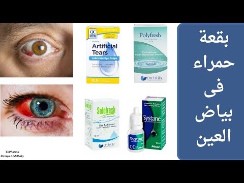 سبب ظهور تجمع دموى فى بياض العين وعلاجها