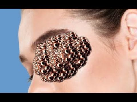 ASMR treatment maggots removal infest cartoon eyes..asmr animation #asmr #animation #2danimation