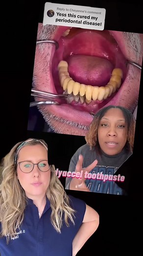 Reverse Your Dental Issues with Expert Tips