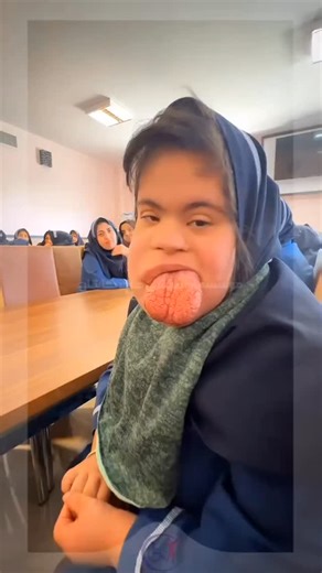 ‎راز ویو های میلیونی اینستاگرام‎ | ‎🛑اگه میتونید به درمان بچه هایی که جونشون در خطره یا درد زیادی میکشند کمک کنید کلمه👈 فرشته رو کامنت کنید بچه های زیادی داریم که بخاطر...‎ | Instagram