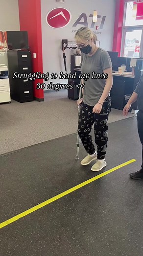 But hey my brace isn’t locked straight anymore #mpflreconstruction #kneesurgery