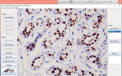 Fiji统计免疫组化阳性细胞数