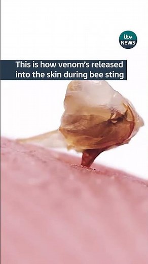 This is how venom’s released into the skin during bee sting #itvnews #bee