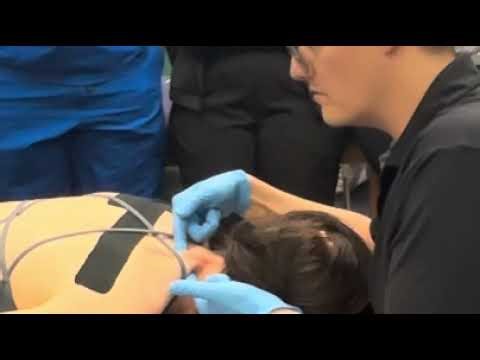 Dry Needling Suboccipital Muscles