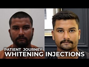 Whitening Injections | The Ultimate Solution for Radiant, Even Toned Skin