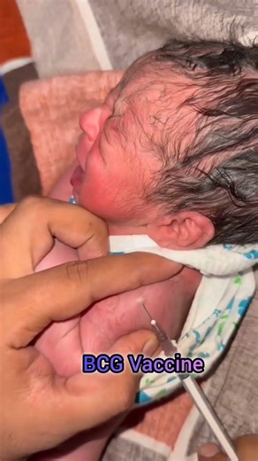 BCG Vaccine #vaccination #children #childbirth #viralvideo