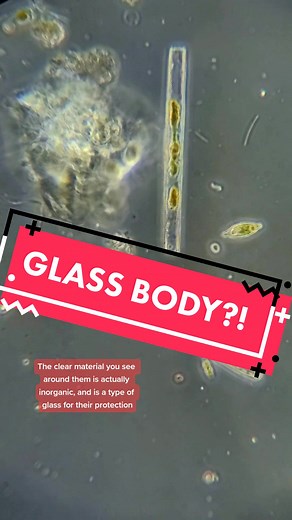 Exploring Diatoms Under Microscope: Glass Body Revealed