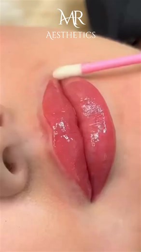 💋 Discover the beauty of hassle-free lips with our Permanent Lip Color. No more reapplications needed, no more worries. It's your secret to effortless, all-day beauty that keeps you looking fabulous without any effort. Experience the freedom of true beauty! 💄 For inquiries and appointments, contact us at ☎️0325 9611110 📞0329 9611110 📌 MR Aesthetics 📍71-A Main Boulevard Gulberg, near Siddique Trade Centre, Lahore, Pakistan Operating Hours: Monday to Saturday ⏰ 12pm to 9pm #AllDayColor #Stunn