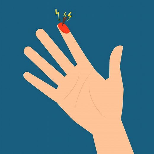 Here's what happens if you leave a splinter in your skin for too long. | Insider Science