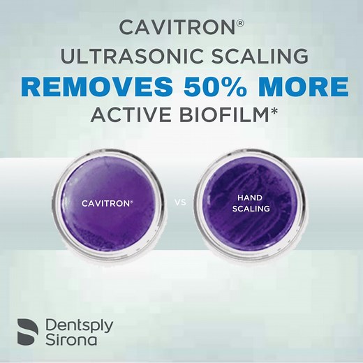 192 reactions · 21 shares | Eye-opening data: Cavitron® ultrasonic scaling systems are now proven to remove 50% more active biofilm* than hand scaling. | Dentsply Sirona | Facebook