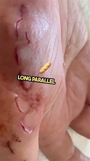 what the sign of dolphin attack?