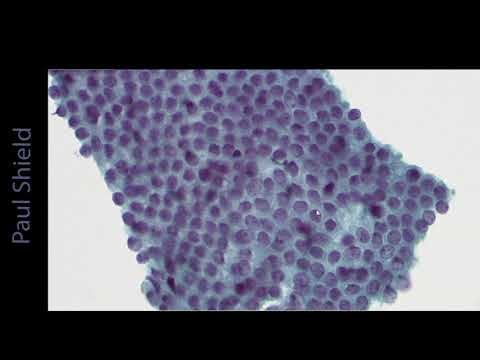 Endocervical cells
