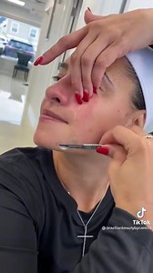 124K views · 172 reactions | ✨ DONR FORGET TO TRY DERMAPLANING  | Tutorial Makeup dan Fashion | Facebook