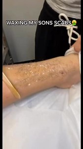 318K views · 14K reactions | She pulled my scab off  | Devin Appice | Facebook