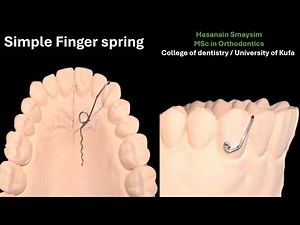 Simple finger spring wire bending, design animation, activation and action simulation (voiced)
