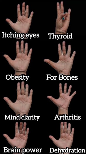 One simple Yog Mudra, multiple healing benefits Practice this powerful hand gesture daily to support itchy eyes, thyroid balance, obesity control, bone strength, arthritis relief, mind clarity, brain power, and dehydration. Just 5–10 minutes a day can help balance your body naturally #YogMudra #HealingMudra #AcupressurePoints #NaturalHealing #YogaForHealth ( MindBodyBalance, HolisticWellness, Panchbhootyog, naturopathy, acupressure points, healings, practice, yoga, naturally ) | panchbhootyog