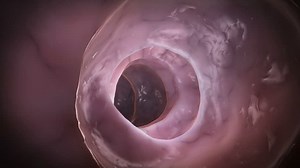 dentro de un colon saludable: video de stock (totalmente libre de regalías) 5040380 | Shutterstock