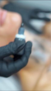 4.6K views · 52 reactions | Full skin treatment video now live on my YouTube channel拾 Skin Perfect Medical https://youtu.be/QCIofutlyA0?si=SIY6D2hQ8HQ9_x3u | Natalie Eva Marie | Facebook