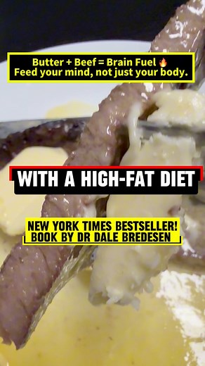 Healthy fats for the brain – Butter (especially grass-fed) provides saturated fat and cholesterol, which the brain needs for cell membranes and myelin. It also contains vitamin K2 and butyrate, which may have anti-inflammatory effects. #butter #beef #butyrate #cholesterol #carnivorelifestyle #alzheimer #bestseller | Tinay & Tinoy Dallas Texas