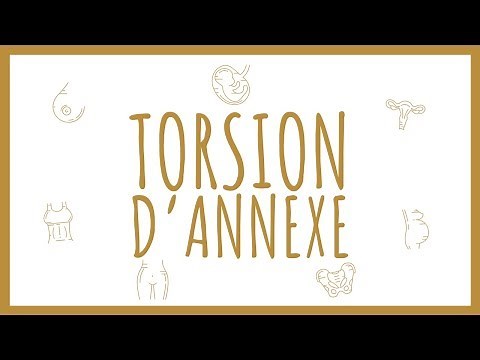 Sémiologie Gynécologique - Torsion d'Annexe