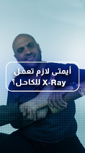 2.9K views · 63 reactions | Did you injure your ankle? Before rushing to get an X-ray, watch this video to learn about the signs that indicate that getting an X-ray is necessary. #AnkleInjury #XRayEvaluation #HealthAwareness | Dr. Elie Metni | Facebook