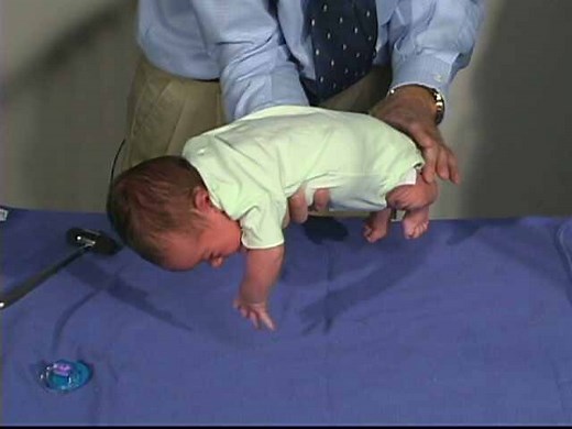 Neurologic Exam-Pediatric | Newborn | Normal | Positions - Ventral Suspension