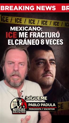 Un inmigrante mexicano está vivo de milagro, luego de que agentes de Ice le golpearon la cabeza con botones metálicos al punto de dejarlo inconsciente. Afortunadamente se pudo recuperar y habló con la prensa #Inmigrante #Mexicano #Mondragón#Golpiza#ice