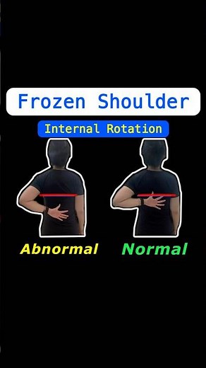 Frozen Shoulder 4 Exercises for Improving Shoulder Internal Rotation. #shoulderpain #frozenshoulder