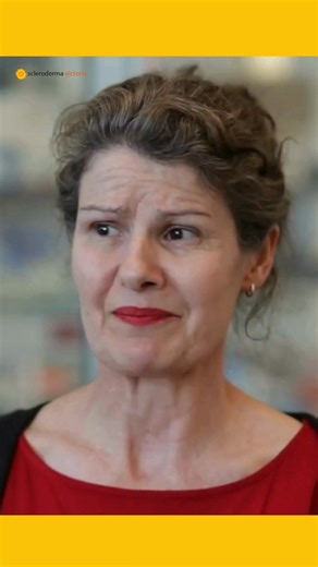 Hear Kathleen share the daily challenges her patients face and why ongoing support is vital for people living with this rare and chronic condition! Scleroderma nurses play a crucial role in improving the quality of life for patients. They: - Provide expert care, advice, and education on managing treatment, wound care, and clinical appointments - Support data collection and research to deepen our understanding of scleroderma - Offer compassion and reassurance, reminding every patient that they ma