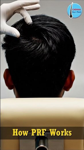How PRP Hair Treatment Works? 💉 | Stop Hair Fall Naturally | PRP Explained